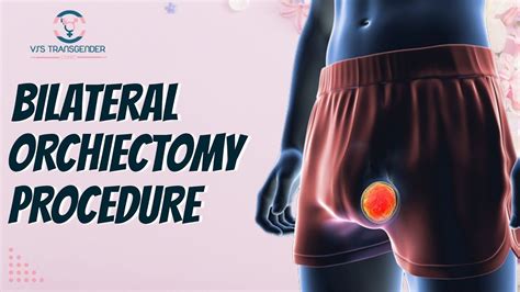 The procedure under general anesthesia takes a maximum of 1 hour, and it can be carried out in the same section with vaginoplasty. . Bilateral orchiectomy before and after